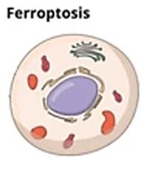 Exploration of the Role of Ferroptosis in Stroke
